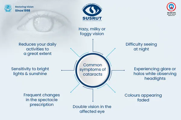 Cataract Surgery